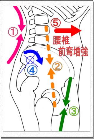 腰痛とセックスについて 【鍼灸師が執筆・監修】